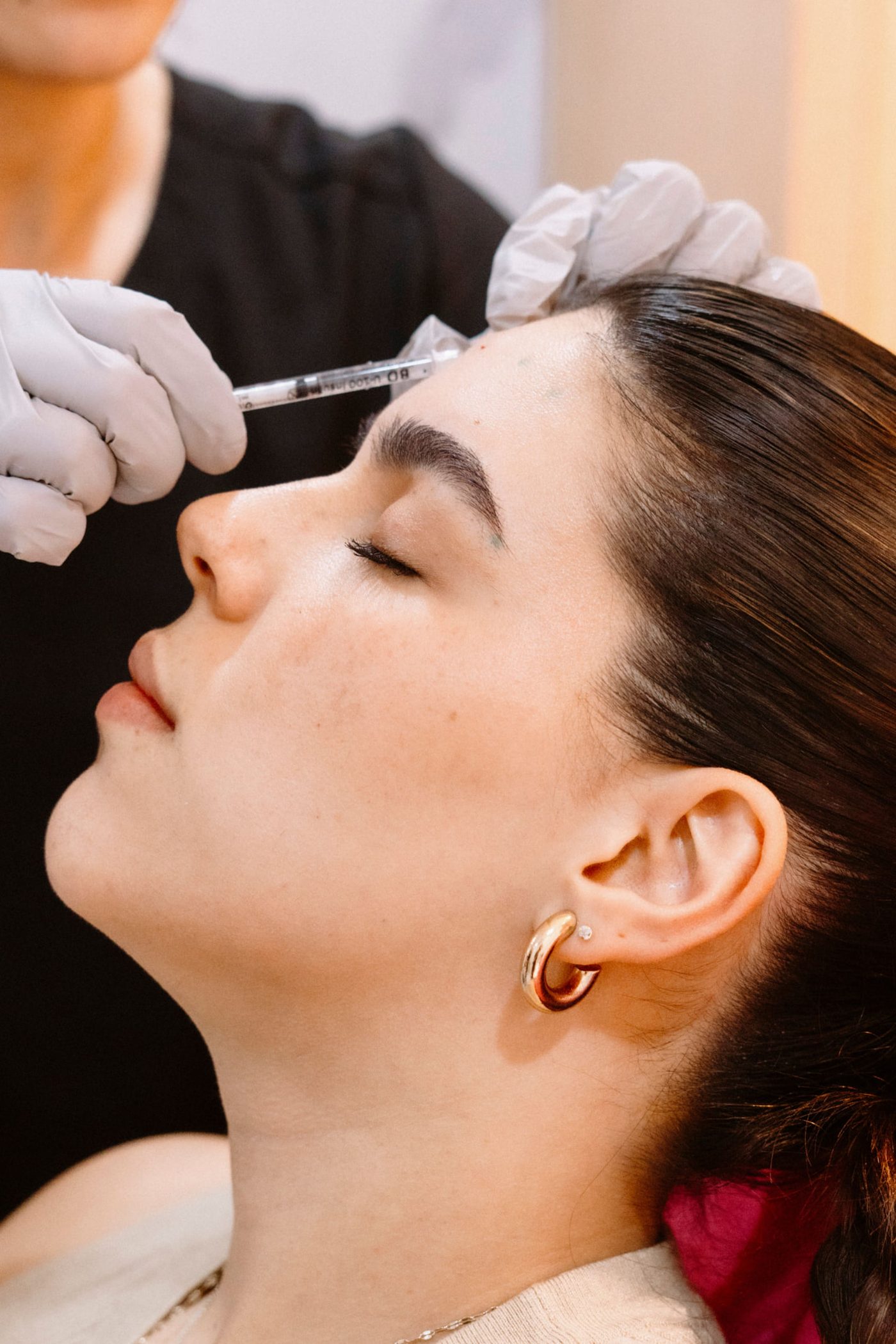 Botox behandeling voorhoofd door een BIG geregistreerde arts bij Clinic-C