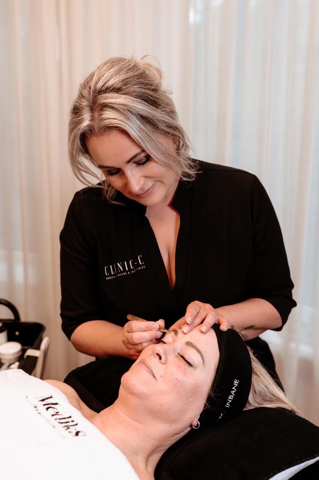 Microneedling bij huidkliniek Clinic-C in Zevenbergen