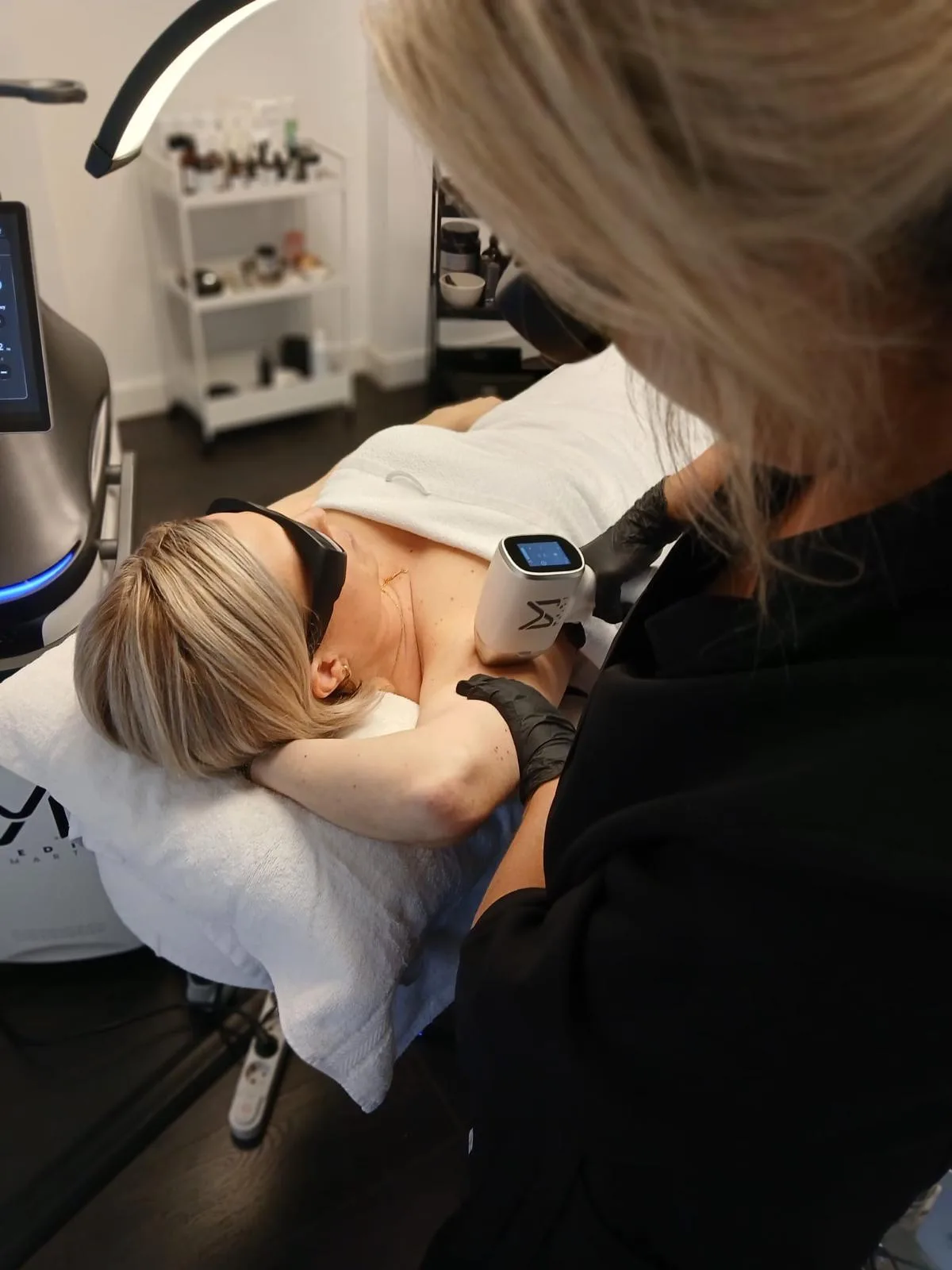 Laserontharing