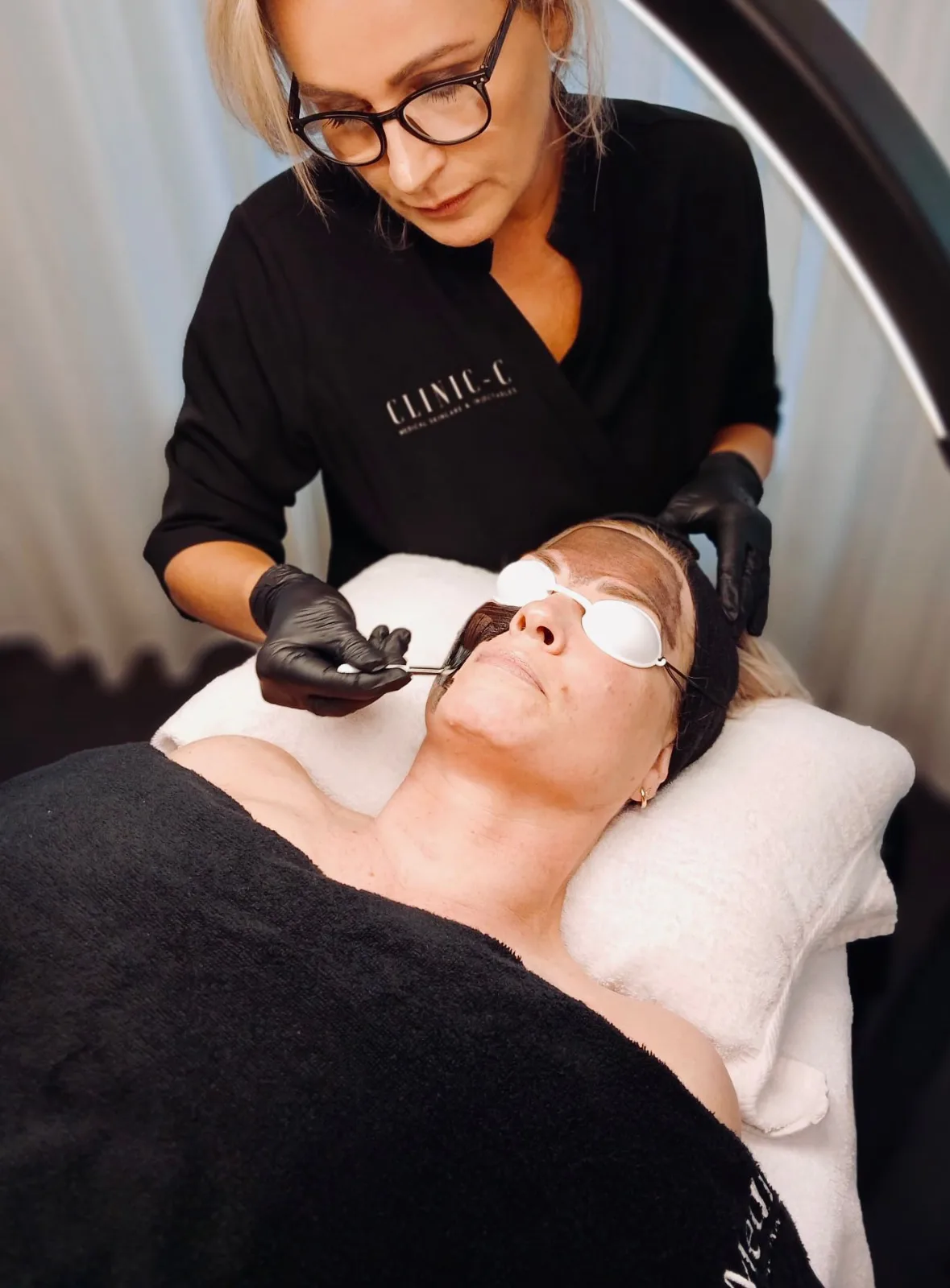 Carbon Peeling (Hollywood Peel)